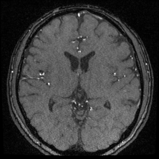 Click on the Serie image to view the images of VILLANUEVA, WILLIAM A.